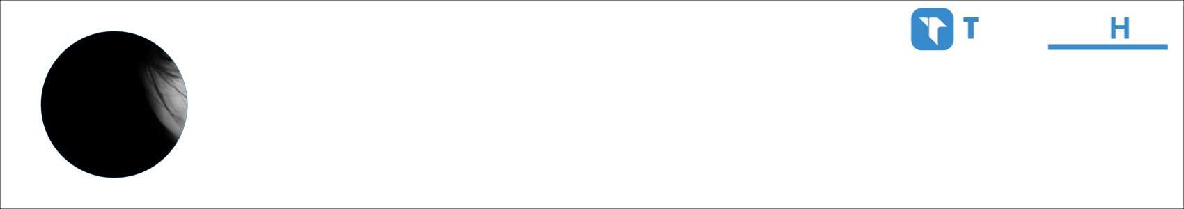 Henkka Activity Banner