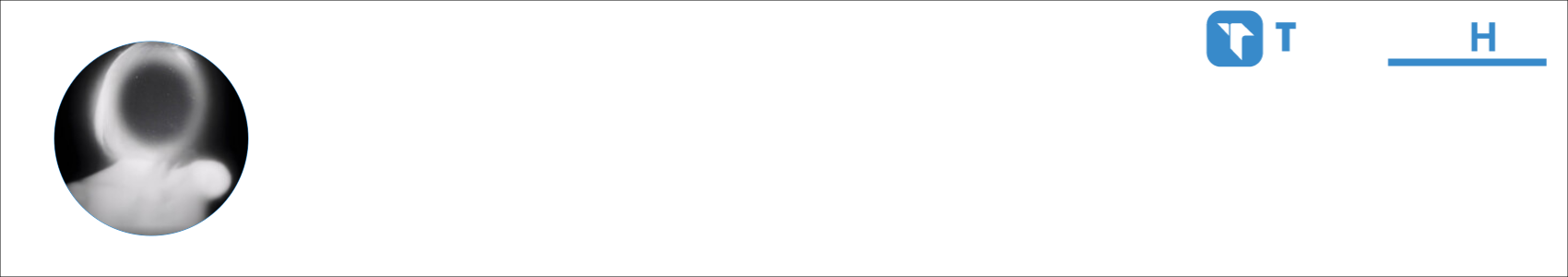 333.SHNT Activity Banner